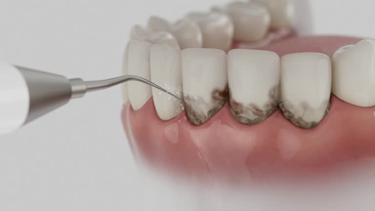 Reliable Dental contractor in Del Monte Forest, CA by Smile Center Dentistry